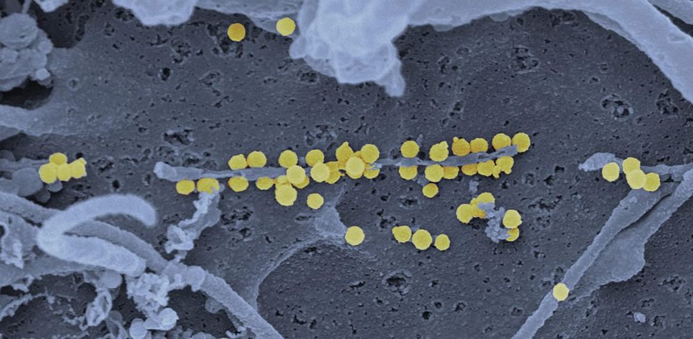 Deadly CCHF virus: What you need to know about its symptoms and prevention post image
